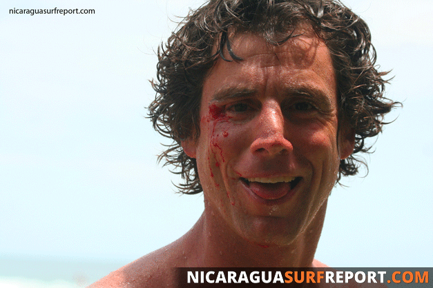 Nicaragua Surf Report - Report Photo 07/31/2008  3:56 PM 